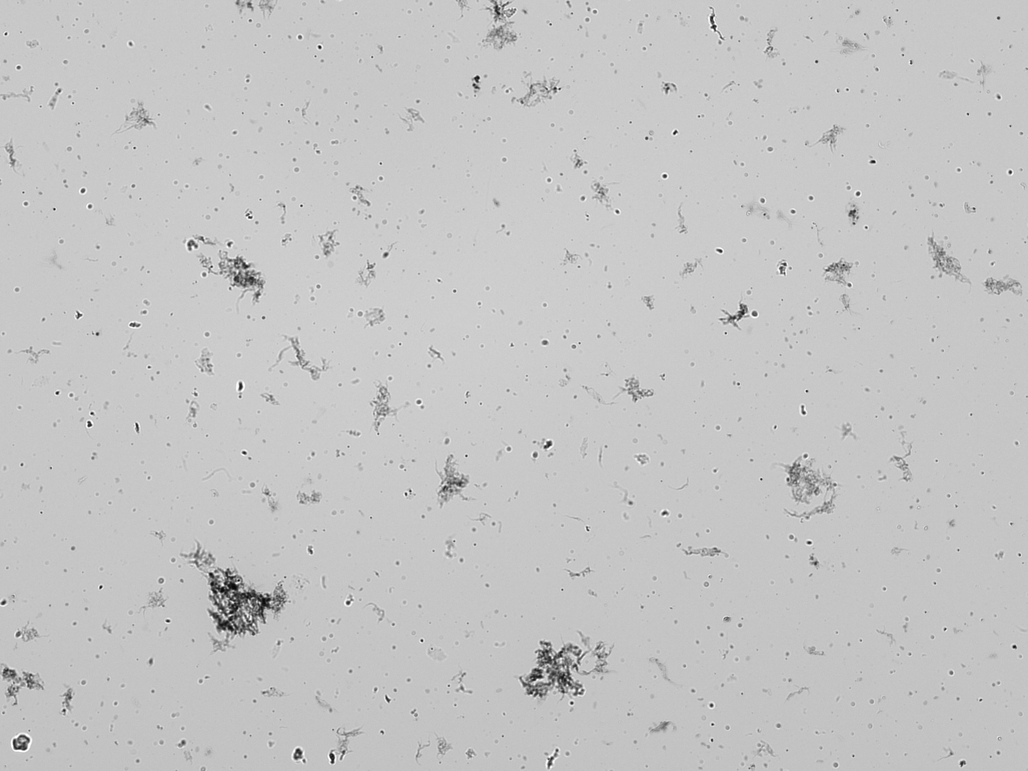 Brightfield micrograph of a cell counter chamber dominated by large irregular dark clumps and stringy debris with few discrete round particles, characteristic of a poorly cleaned electric organ prep contaminated with extracellular matrix fragments.