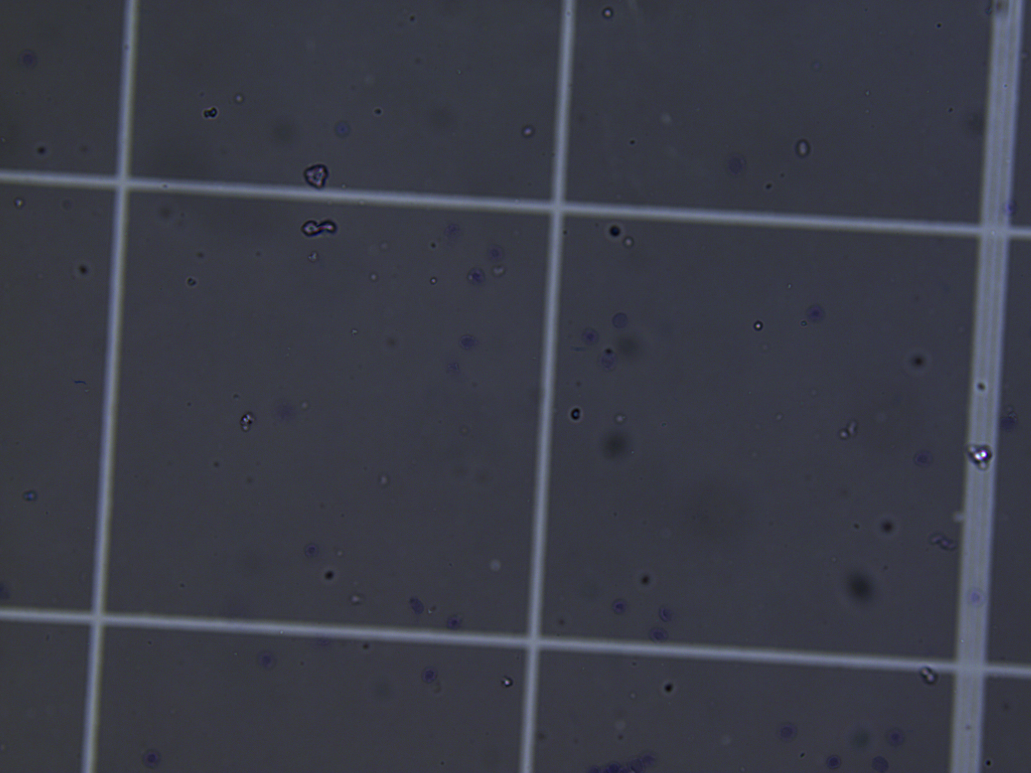 20x brightfield micrograph of a hemocytometer field showing a mostly empty grid with a small number of well-separated round particles distributed across the field — a dramatic visual contrast with the dense pre-cushion field.