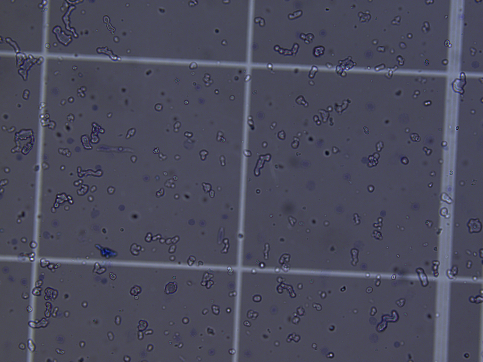 20x brightfield micrograph of a hemocytometer field showing dense, crowded particulate matter with stringy fragments and small irregular debris, in which discrete nuclei are hard to distinguish from the surrounding myelin debris.